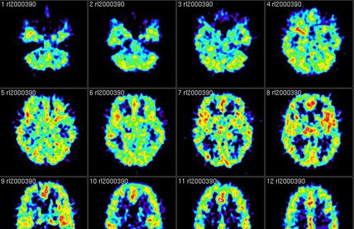 So sieht das Gehirn für einen Neurowissenschaftler aus. Wie verändert sich aber die Betrachtung, wenn ein Soziologe sich die Zusammenhänge zwischen dem menschlichen Gehirn und seinem gesellschaftlichen Umfeld ansieht? 