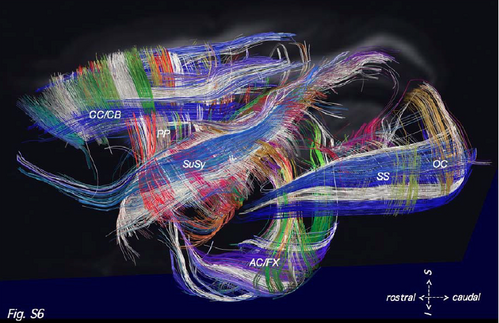 (Coherent grid structure of the pathways of the owl monkey cerebral hemisphere, left lateral view. Wedeen et al., 2012 Suppl. p.18)